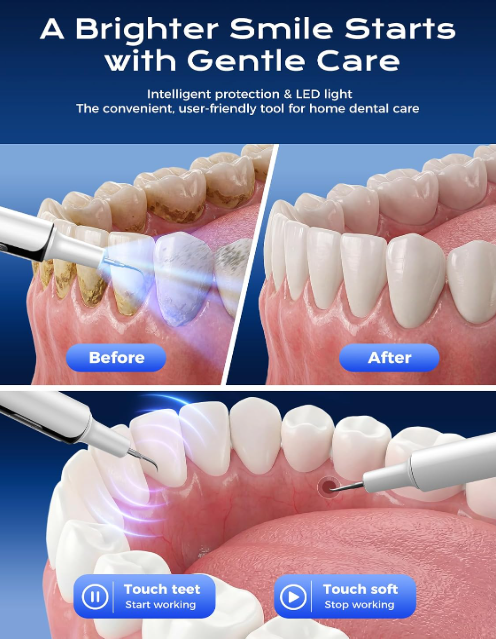 Ultrasonic Dental Plaque and Tartar Remover
